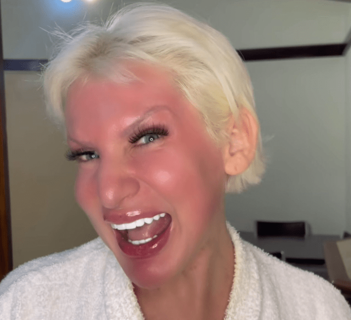 Influenciadora Roma Gaga Mostra Resultados Impressionantes com Peeling de Fenol no Resorto