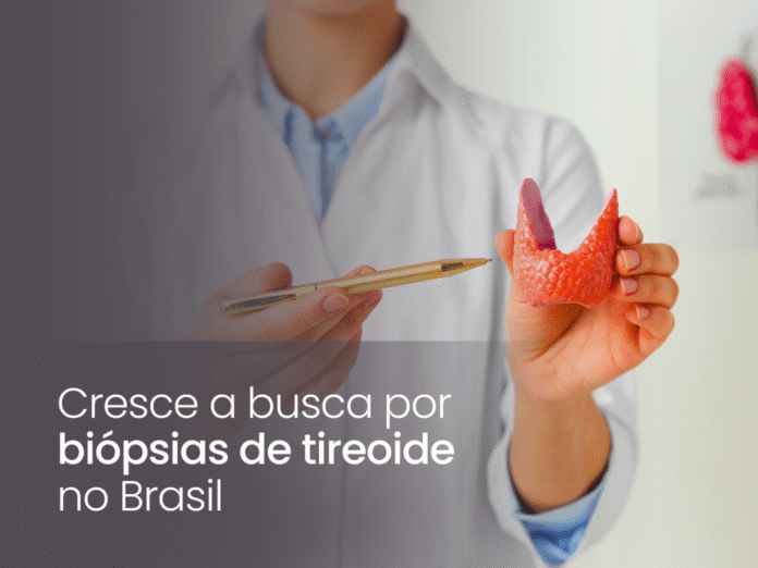 Cresce a busca por biópsias de tireoide no Brasil